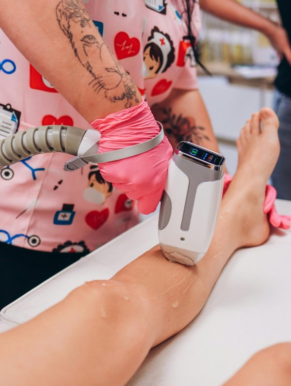 L'épilation laser pour éliminer les poils durablement : la révolution esthétique